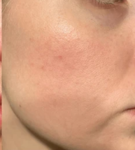 Before and after